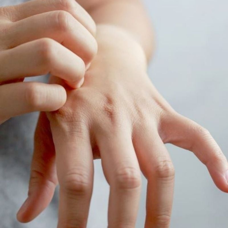 close up of female hand scratching back of other hand with nails