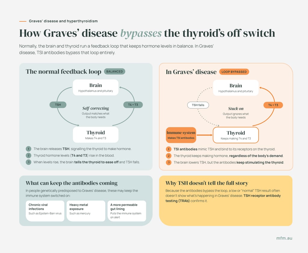 graves-disease-hyperthyroidism-how-it-bypasses-the-off-switch infographic comparing the normal feedback loop between brain and thyroid and the bypassed loop that occurs in graves' disease